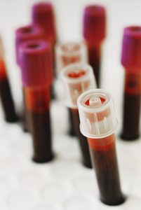 Vacutainer tubes filled with blood. Image courtesy of the UBC Centre for Blood Research (CBR).