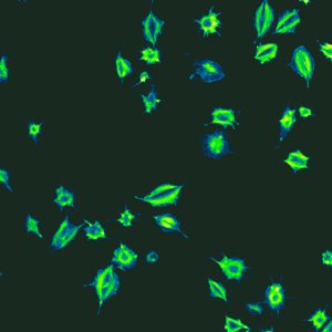 Image of the winning entry from the CBR Cover Art Contest, April 2022: platelets activating their function, which look like green splashes on a black background