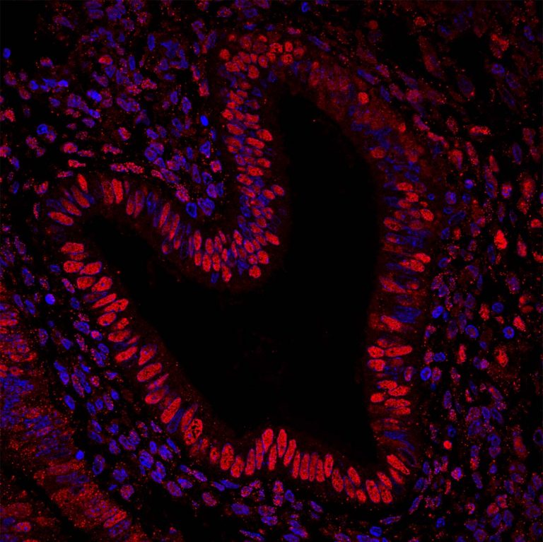 Image submitted by Dr. Isabel Pablos to the CBR Cover Art Contest, April 2022: Staining of HMGB1 in human endometrium, which looks like a red and blue heart on a black background