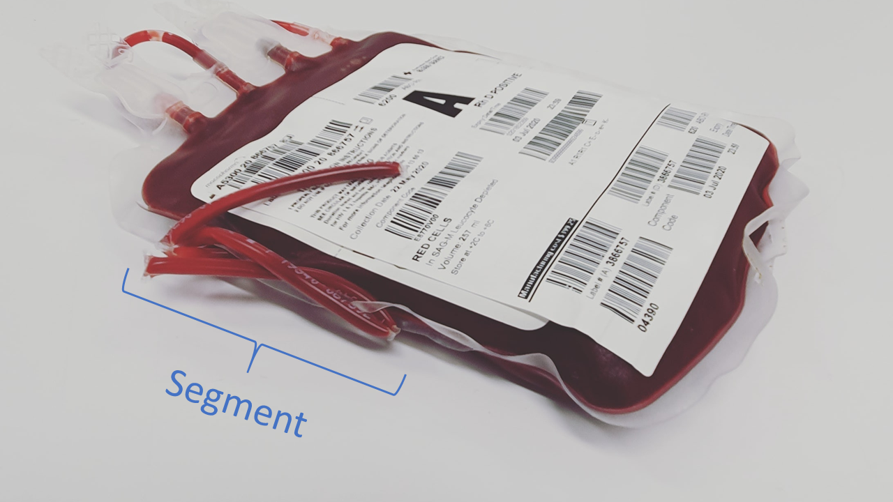 An RBC blood bag, with segment tubing labeled.