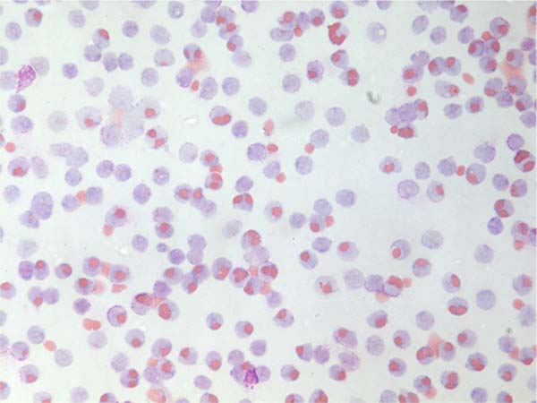Reddish purple and pink dots on a white background, depicting red blood cells. Submitted to the November 2022 CBR Cover Art Contest.