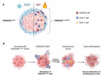 Figure 1. The tumor-specific PODO447 epitope is a new therapeutic target for ovarian cancer treatment. (A) The PODO447 epitope is a new biomarker of ‘cold’ tumors in ovarian cancer. (B) A PODO447 antibody drug conjugate (ADC) may help eliminate tumor cells in chemoresistant and recurrent ovarian cancer by turning ‘cold’ tumors ‘hot’. Figure made with BioRender.com and is a modified version of Fig 6 from Brassard et al,  Front. Oncol., 21 December 2023.